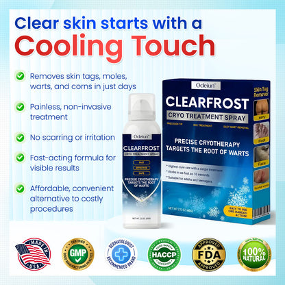 Odeiun™ Clearfrost Cryo Relief Spray🔥 – Advanced Wart & Skin Tag Removal Solution