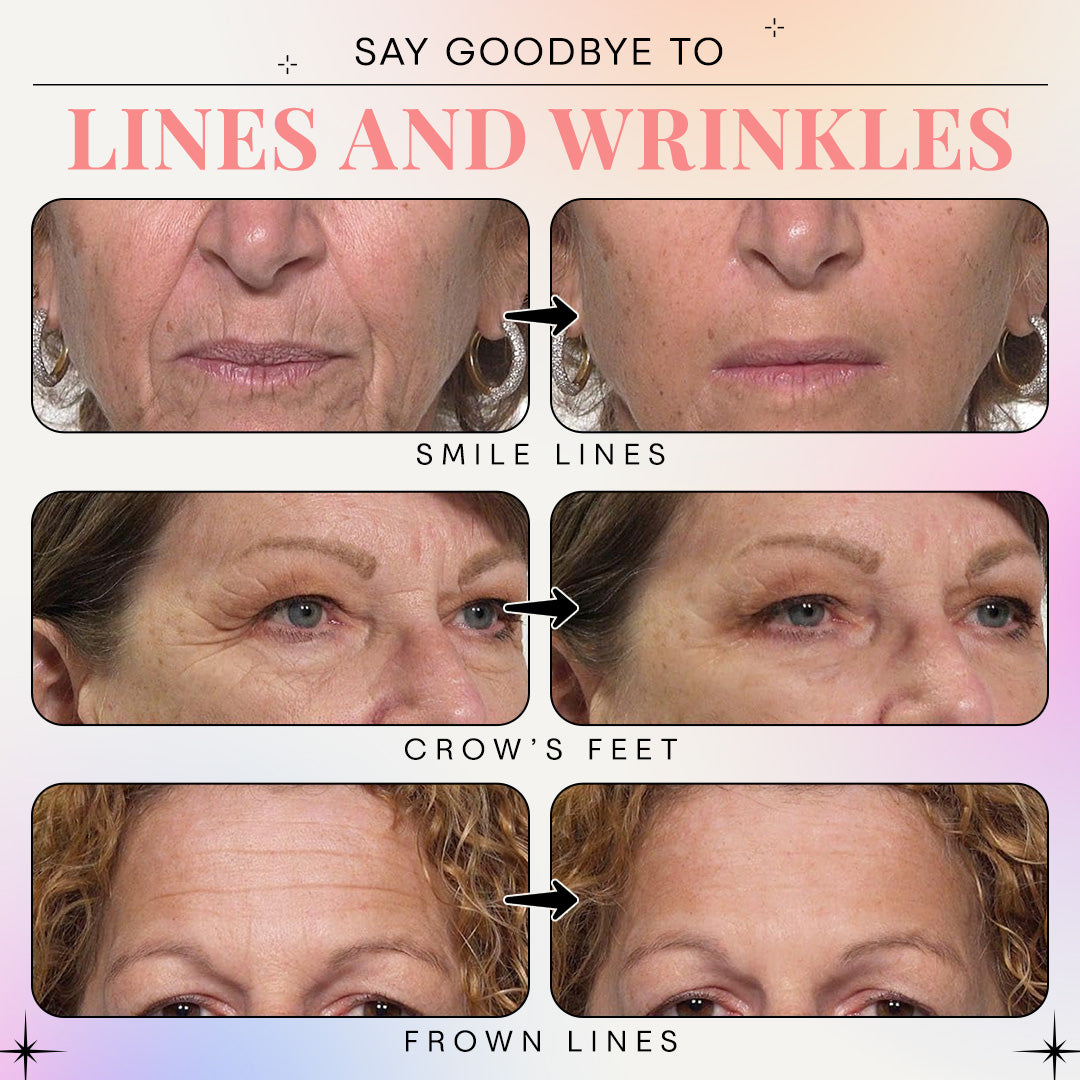 LBMLBM™ Rapid Reduction Wrinkle Serum