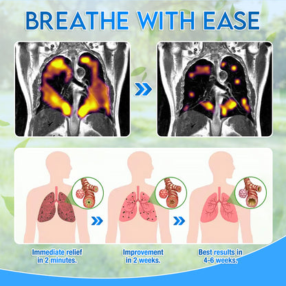 ✅Official Store: ODEIUN™ Herbal Lung Detox Inhaler 👑 (💝 Effectively relieves cough, wheezing, shortness of breath, phlegm, nasal congestion, bronchitis, allergy symptoms, and lung discomfort 💝)
