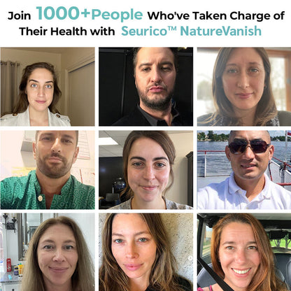 Official Boutique: Seurico™ Nature Erase Serum – Naturally Fades Moles & Spots
