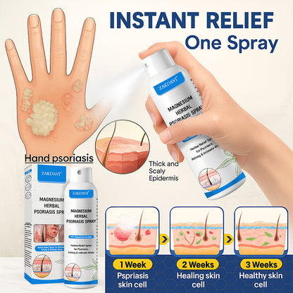 ✅Official Store:  Zakdavi™ Magnesium Herbal Psoriasis Spray – FDA Certified Relief for Psoriasis, Eczema & Skin Tags