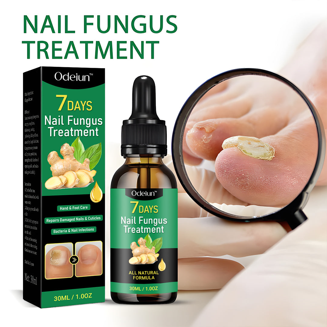 2025 New & Upgraded Negusy™ Advanced Nail Repair & Fortifying Essence