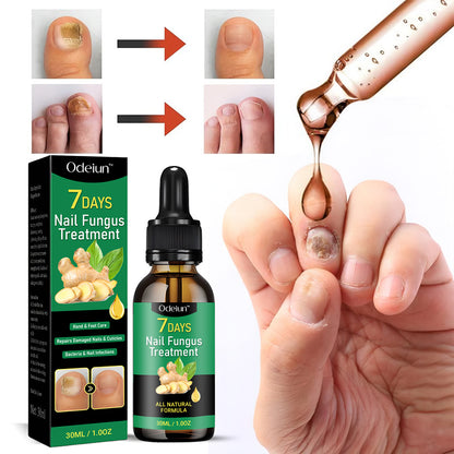 2025 New & Upgraded Negusy™ Advanced Nail Repair & Fortifying Essence