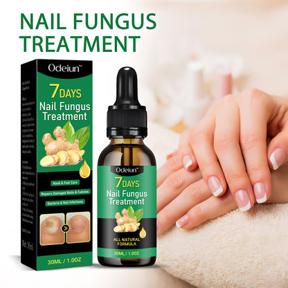 2025 New & Upgraded Negusy™ Advanced Nail Repair & Fortifying Essence