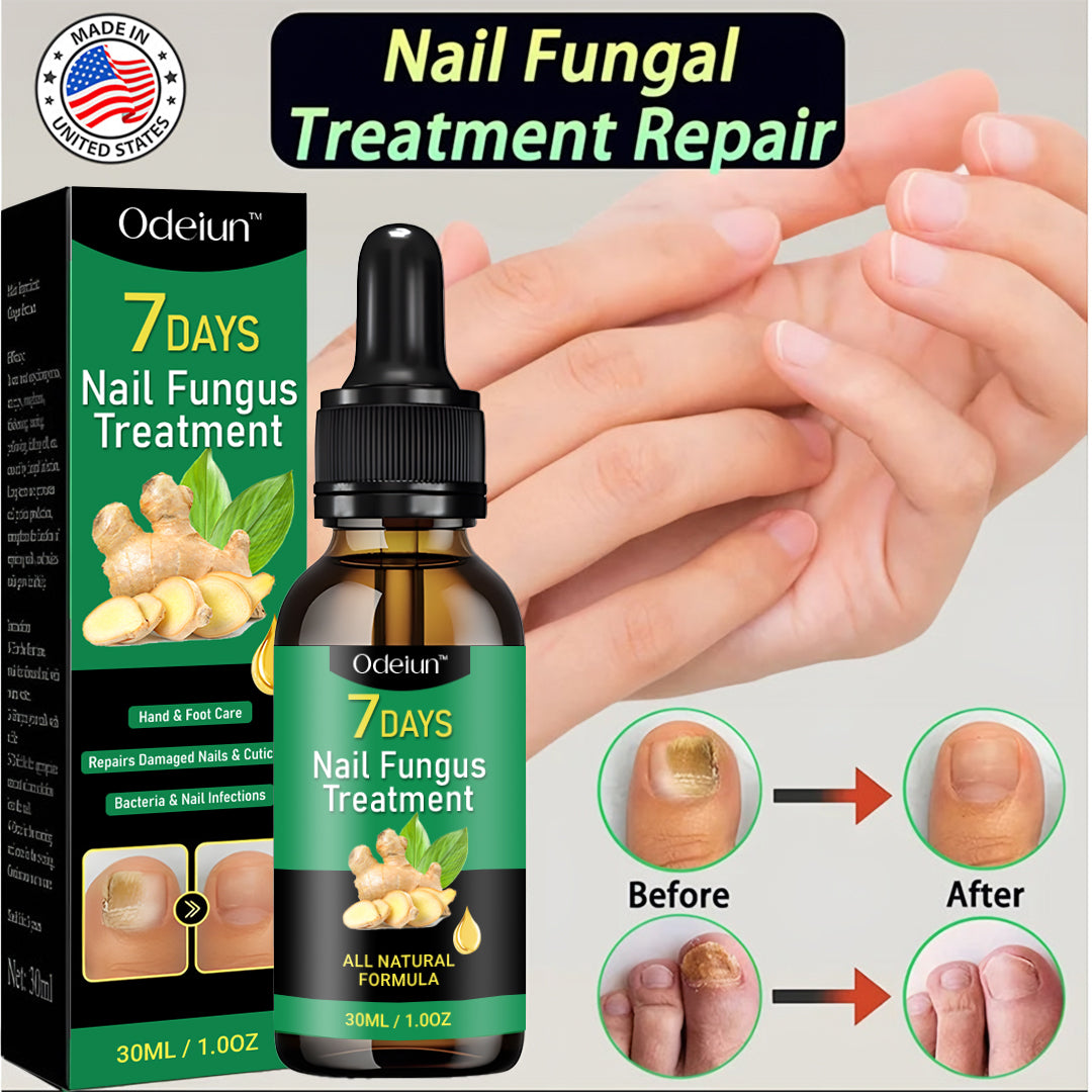 2025 New & Upgraded Negusy™ Advanced Nail Repair & Fortifying Essence