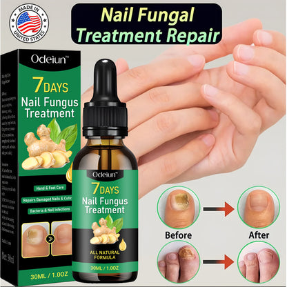 2025 New & Upgraded Negusy™ Advanced Nail Repair & Fortifying Essence