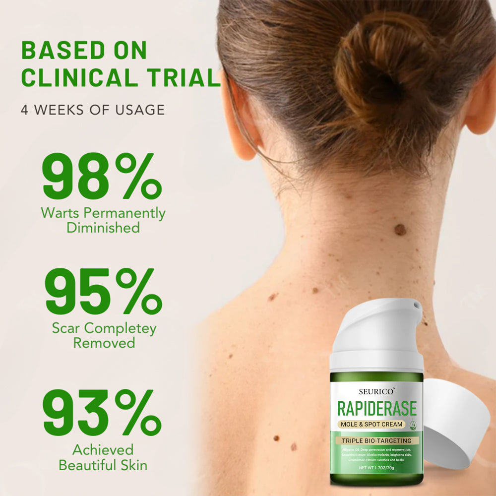 ✅ Official Store:  Seurico™ RapidErase Mole & Spot Cream