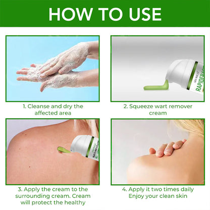 ✅ Official Store:  Seurico™ RapidErase Mole & Spot Cream