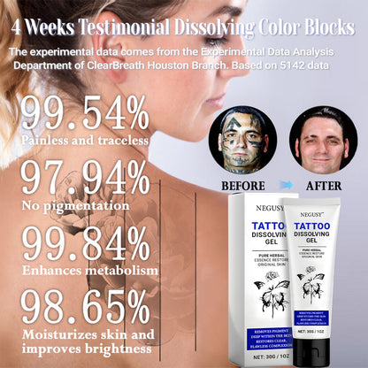 💖Limited time discount sale🚀 - Negusy™ Tattoo Dissolving Gel