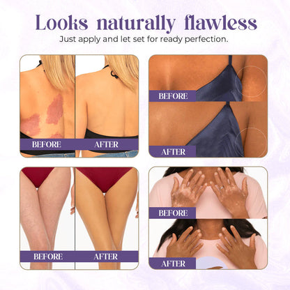 ✨ Zakdavi™ Luxe Body Coverage Perfector | Achieve Silky, Flawless Skin in Seconds 💎