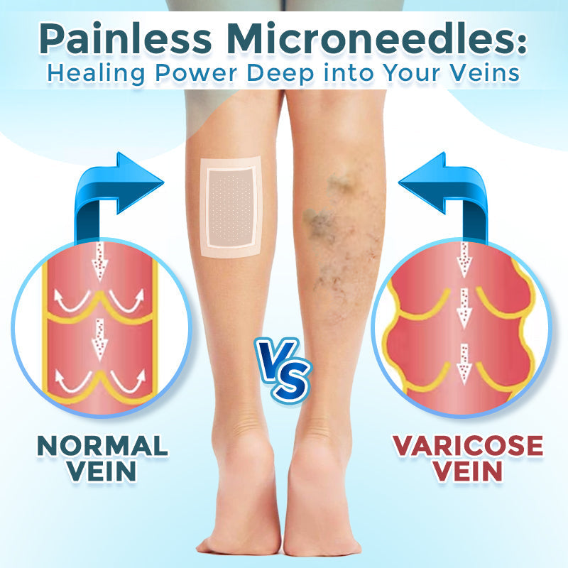 ODEIUN™ VenaRestore MicroNeedle Vein Repair Patch | 💙 Varicose Vein Relief ✨ Circulation Support 🦵 Leg Care [Official Flagship Store]