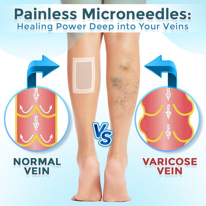 ODEIUN™ VenaRestore MicroNeedle Vein Repair Patch | 💙 Varicose Vein Relief ✨ Circulation Support 🦵 Leg Care [Official Flagship Store]