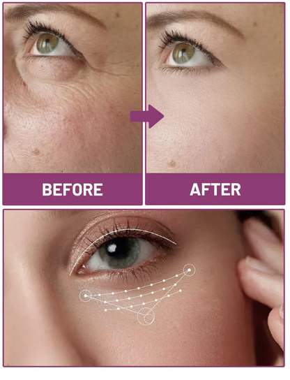 Calcium Multi Balm | Firm, Smooth & Hydrate in 7 Days