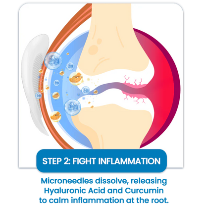 Odeiun™ Hyaluronic Acid Joint Relief Microneedle Patch