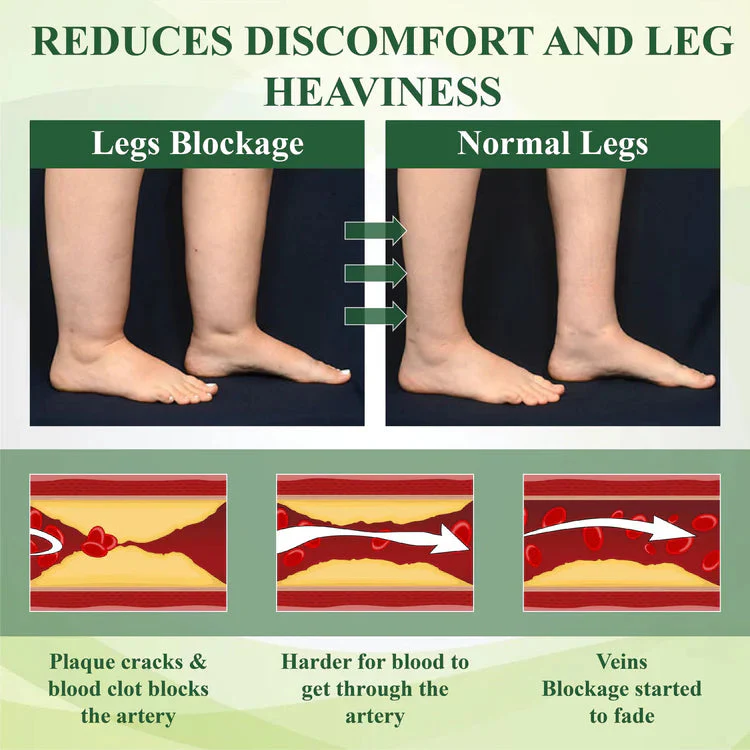 Zakdavi™ FluidEase Leg Therapy Cream | Reduce Swelling, Improve Circulation