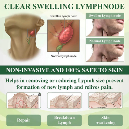 Zakdavi™ FluidEase Leg Therapy Cream | Reduce Swelling, Improve Circulation