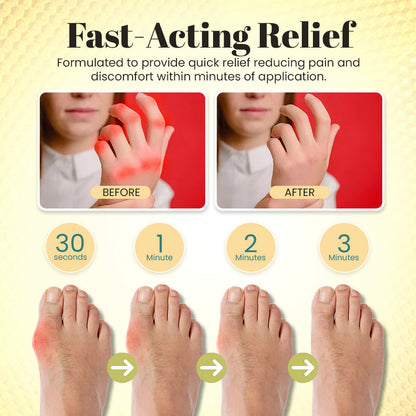 🐝 Negusy™ Bee Venom Professional Care Gel – Fast-Acting Relief for Joints & Muscles 💪✨