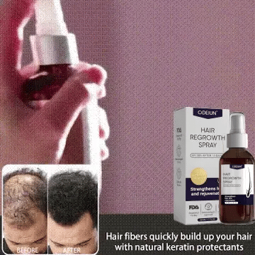 🌿 Odeiun™ Natural Hair Regrowth Spray – Naturally regrow fuller hair and restore your confidence