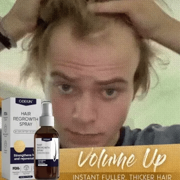🌿 Odeiun™ Natural Hair Regrowth Spray – Naturally regrow fuller hair and restore your confidence