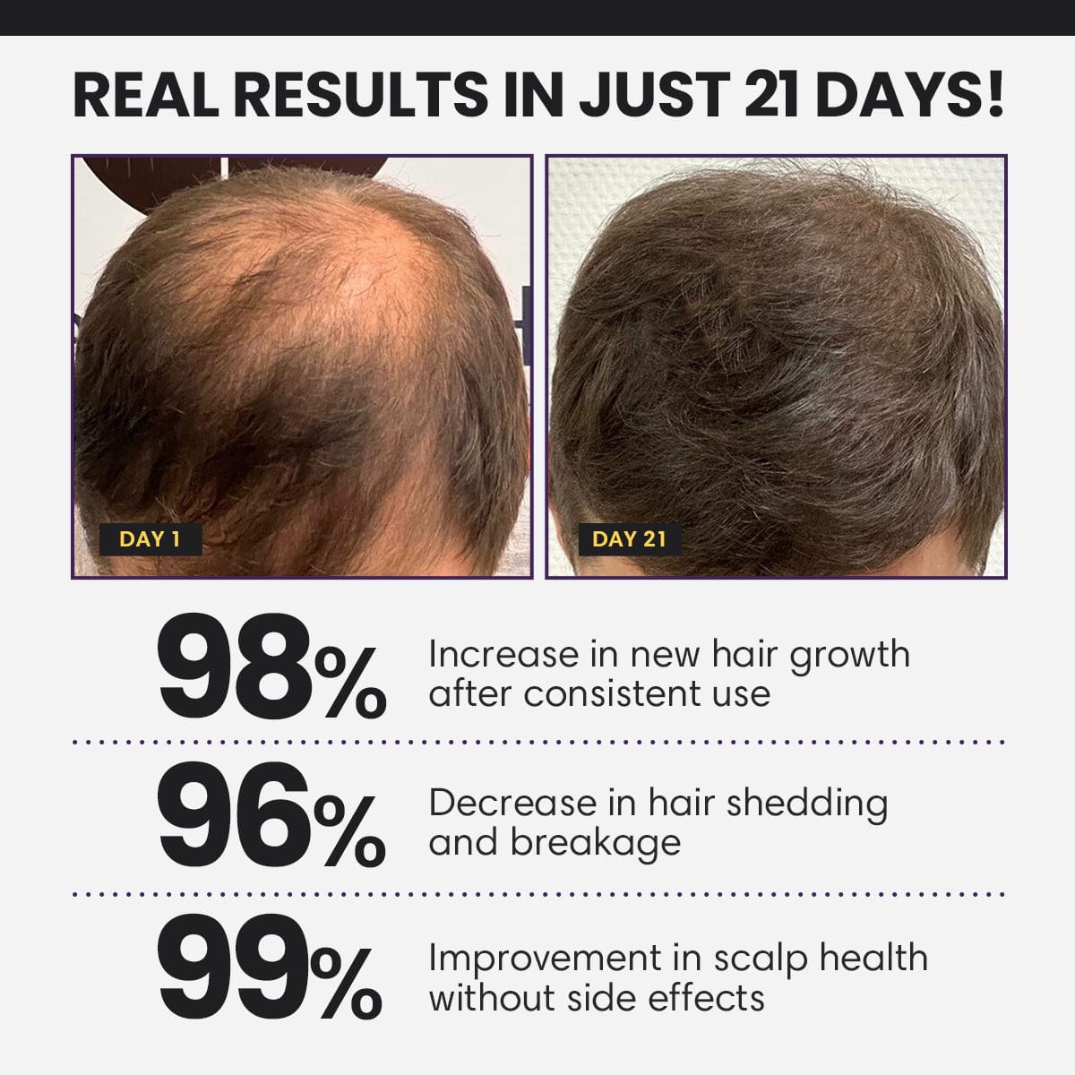 Odeiun™ Follicle Boost 5X Hair Growth Serum